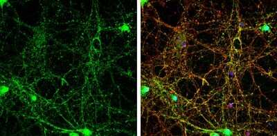 Immunocytochemistry/ Immunofluorescence: SHANK3 Antibody [NBP3-13167]