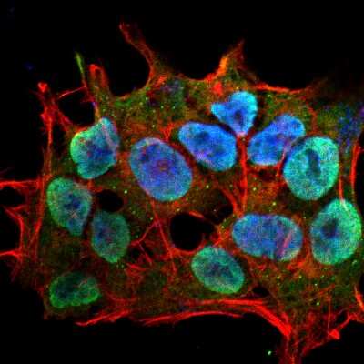 Immunocytochemistry/ Immunofluorescence: SHANK3 Antibody (S367-51) [NBP2-42189]