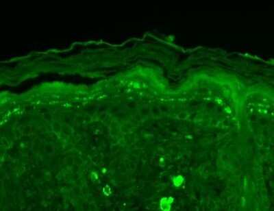 Immunohistochemistry: SHANK3 Antibody (S69) [NBP1-47610]