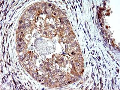 Immunohistochemistry: SHBG Antibody (OTI1H10) [NBP2-45825]