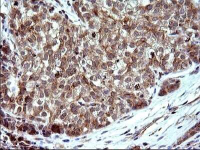 Immunohistochemistry: SHBG Antibody (OTI1H10) - Azide and BSA Free [NBP2-74166]
