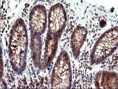 Immunohistochemistry: SHBG Antibody (OTI1H10) - Azide and BSA Free [NBP2-74166]