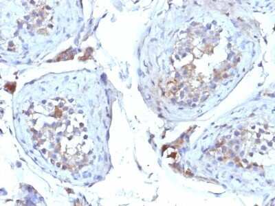 Immunohistochemistry-Paraffin: SHBG Antibody (SHBG/245) [NBP2-44993]
