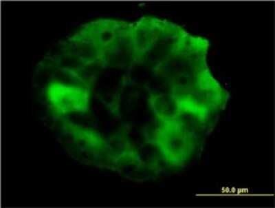 Immunocytochemistry/ Immunofluorescence: SHC1 Antibody (3F4) [H00006464-M01]