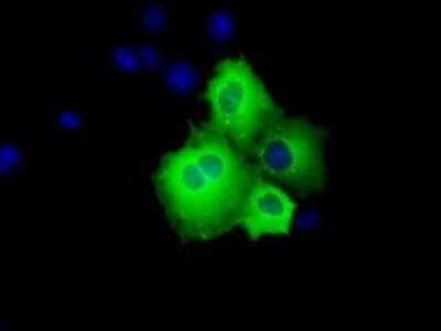 Immunocytochemistry/ Immunofluorescence: SHC1 Antibody (OTI3A1) - Azide and BSA Free [NBP2-74167]