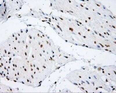 Immunohistochemistry: SHC1 Antibody (OTI3A1) - Azide and BSA Free [NBP2-74167]