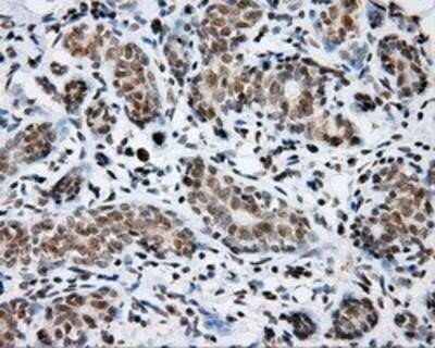 Immunohistochemistry: SHC1 Antibody (OTI3A1) - Azide and BSA Free [NBP2-74167]