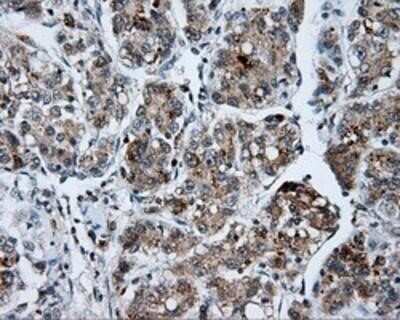 Immunohistochemistry: SHC1 Antibody (OTI3A1) - Azide and BSA Free [NBP2-74167]