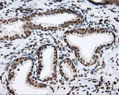 Immunohistochemistry: SHC1 Antibody (OTI3A1) - Azide and BSA Free [NBP2-74167]