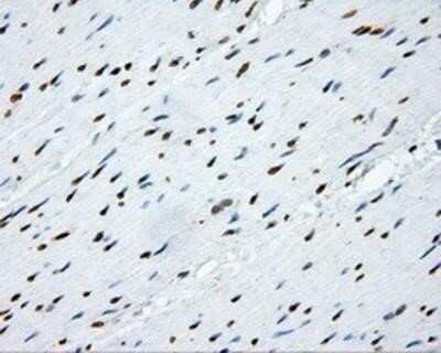 Immunohistochemistry: SHC1 Antibody (OTI3A1) - Azide and BSA Free [NBP2-74167]