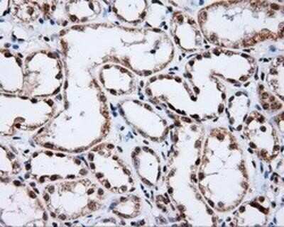 Immunohistochemistry: SHC1 Antibody (OTI3A1) - Azide and BSA Free [NBP2-74167]