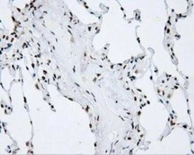 Immunohistochemistry: SHC1 Antibody (OTI3A1) - Azide and BSA Free [NBP2-74167]