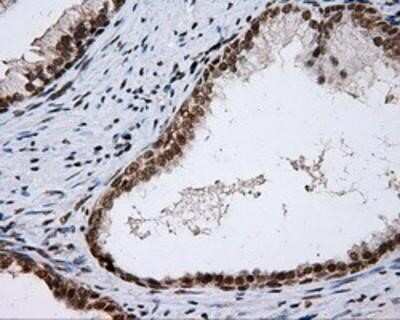 Immunohistochemistry: SHC1 Antibody (OTI3A1) - Azide and BSA Free [NBP2-74167]