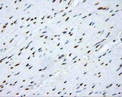 Immunohistochemistry-Paraffin: SHC1 Antibody (OTI3A1) [NBP2-02434]