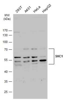 Western Blot: SHC1 Antibody [NBP2-20352]