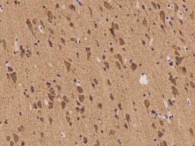 Immunohistochemistry-Paraffin: SHC2 Antibody [NBP2-98061]