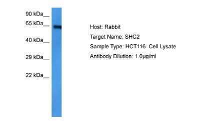 Western Blot: SHC2 Antibody [NBP2-85723]