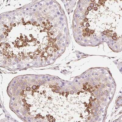 Immunohistochemistry: SHCBP1L Antibody [NBP2-39034]