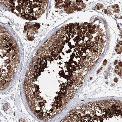 Immunohistochemistry-Paraffin: SHCBP1L Antibody [NBP1-90716]