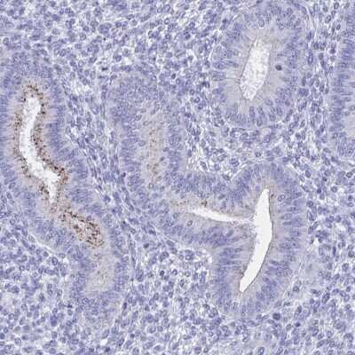 Immunohistochemistry-Paraffin: SHCBP1L Antibody [NBP1-90716]
