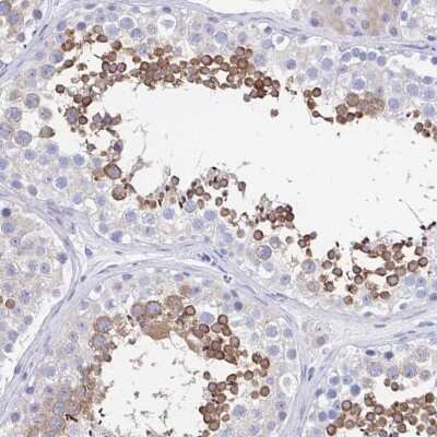 Immunohistochemistry-Paraffin: SHCBP1L Antibody [NBP1-90716]