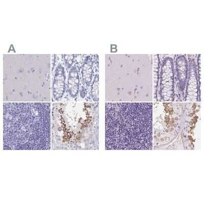 Immunohistochemistry-Paraffin: SHCBP1L Antibody [NBP1-90716]