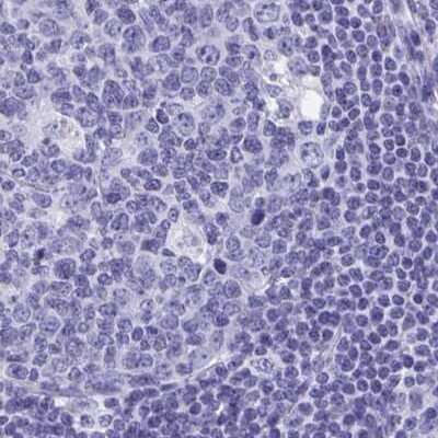 Immunohistochemistry-Paraffin: SHCBP1L Antibody [NBP1-90716]