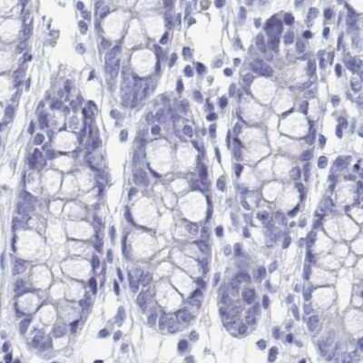 Immunohistochemistry-Paraffin: SHCBP1L Antibody [NBP1-90716]