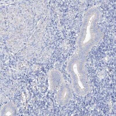 Immunohistochemistry-Paraffin: SHCBP1L Antibody [NBP2-32716]