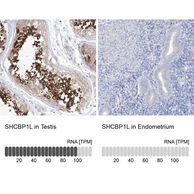 Immunohistochemistry-Paraffin: SHCBP1L Antibody [NBP2-32716]