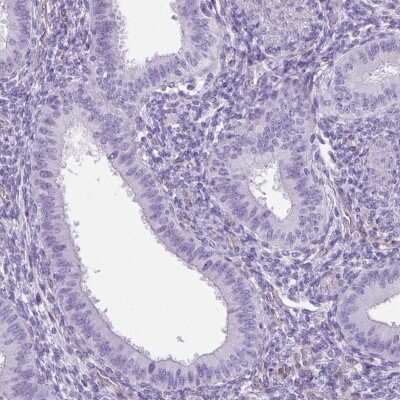 Immunohistochemistry-Paraffin: SHCBP1L Antibody [NBP2-39034]