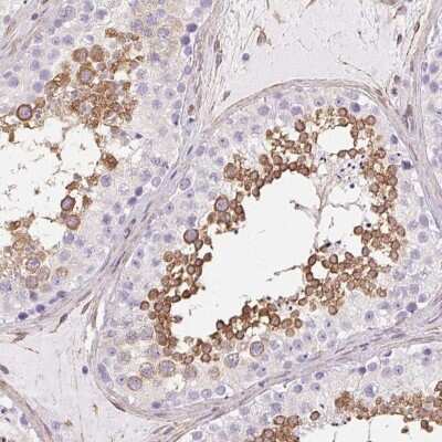 Immunohistochemistry-Paraffin: SHCBP1L Antibody [NBP2-39034]