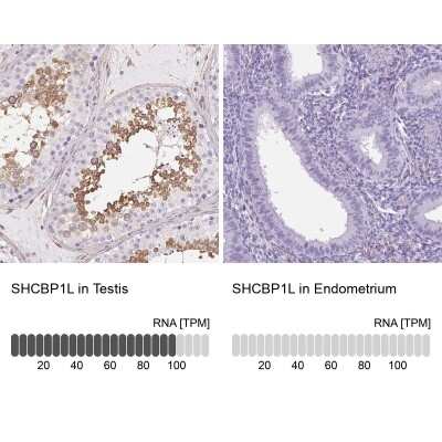 Immunohistochemistry-Paraffin: SHCBP1L Antibody [NBP2-39034]