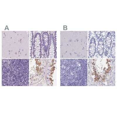 Immunohistochemistry-Paraffin: SHCBP1L Antibody [NBP2-39034]