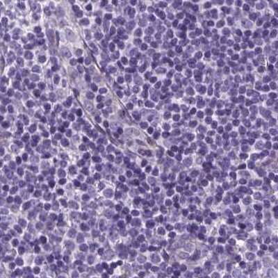 Immunohistochemistry-Paraffin: SHCBP1L Antibody [NBP2-39034]
