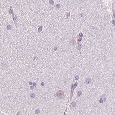 Immunohistochemistry-Paraffin: SHCBP1L Antibody [NBP2-39034]