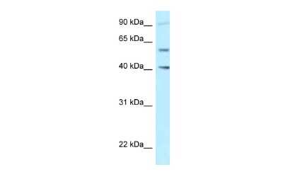 Western Blot: SHCBP1L Antibody [NBP2-88268]