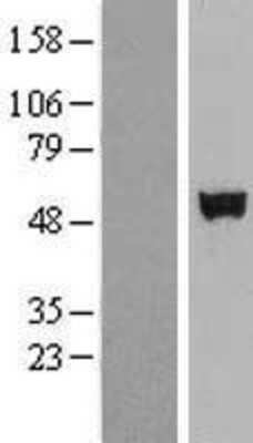 Western Blot: SHE Overexpression Lysate [NBP2-08761]