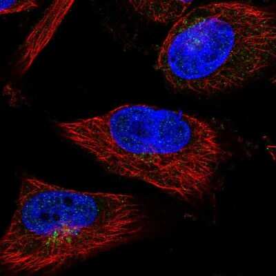 Immunocytochemistry/ Immunofluorescence: SHFM3 Antibody [NBP2-14013]