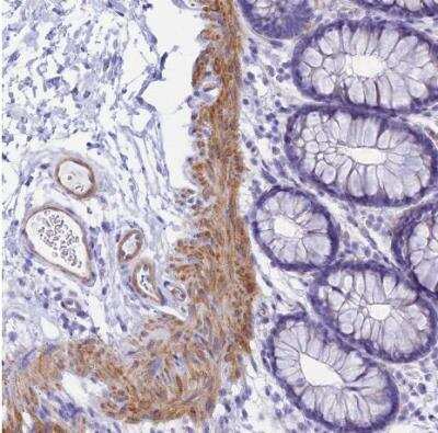 Immunohistochemistry-Paraffin: SHFM3 Antibody [NBP2-14013]