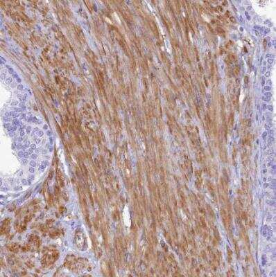 Immunohistochemistry-Paraffin: SHFM3 Antibody [NBP2-14013]
