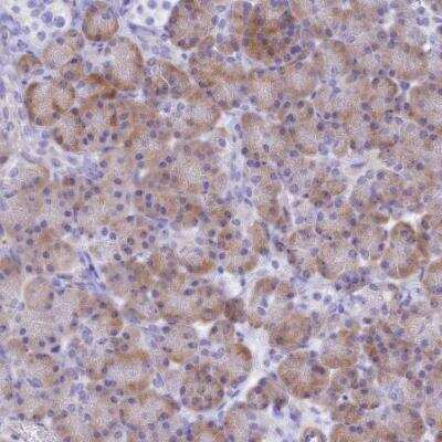 Immunohistochemistry-Paraffin: SHFM3 Antibody [NBP2-14013]