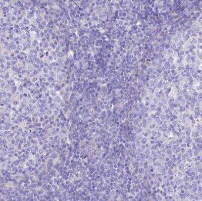 Immunohistochemistry-Paraffin: SHFM3 Antibody [NBP2-14013]