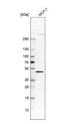 Western Blot: SHFM3 Antibody [NBP2-14013]