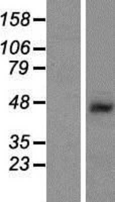 Western Blot: SHFM3 Overexpression Lysate [NBP2-06483]