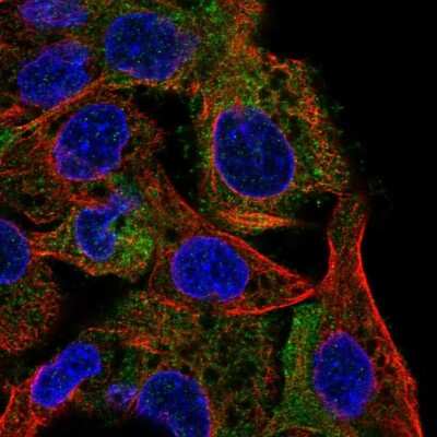 Immunocytochemistry/ Immunofluorescence: SHIP Antibody [NBP2-49633]