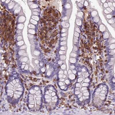 Immunohistochemistry: SHIP Antibody [NBP2-49633]