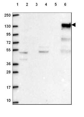 Western Blot: SHIP Antibody [NBP2-49633]