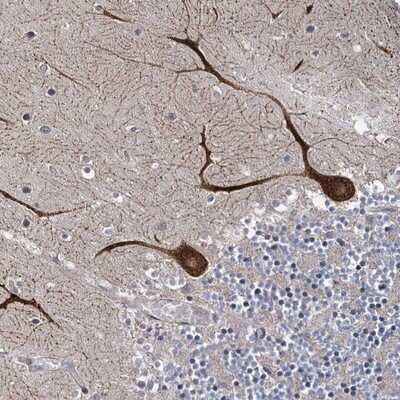 Immunohistochemistry-Paraffin: SHIP2/INPPL1 Antibody [NBP1-87046]