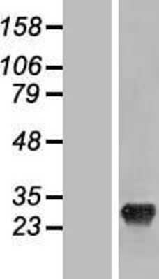 Western Blot: SHISA3 Overexpression Lysate [NBL1-15942]